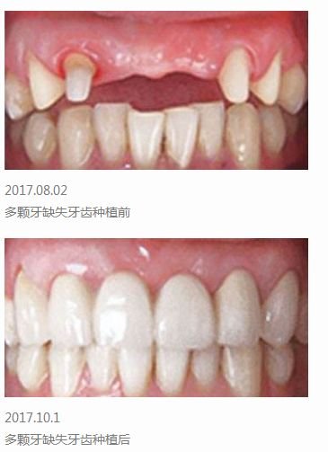 https://img.miyanlife.com/mnt/timg/180630/11393344P-3.jpg