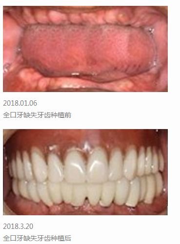 https://img.miyanlife.com/mnt/timg/180630/1139345I8-5.jpg