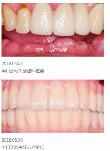 https://img.miyanlife.com/mnt/timg/180630/1139346044-4.jpg