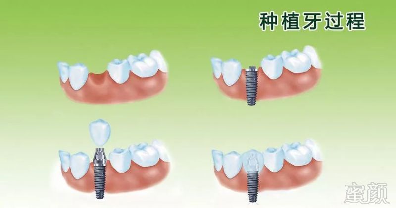 https://img.miyanlife.com/mnt/timg/180630/1141305520-2.jpg