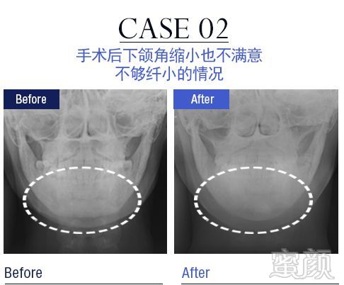 案例图片