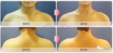 https://img.miyanlife.com/mnt/timg/180630/1214405637-2.jpg