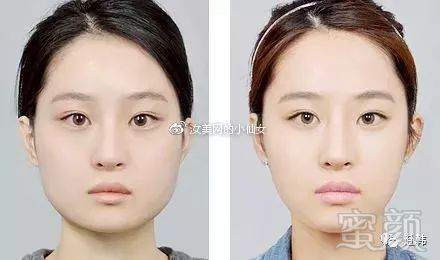 https://img.miyanlife.com/mnt/timg/180630/121440G15-0.jpg