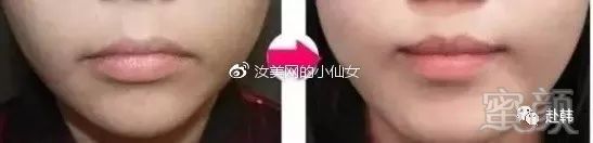 https://img.miyanlife.com/mnt/timg/180630/12144122c-8.jpg