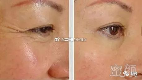 https://img.miyanlife.com/mnt/timg/180630/1214415249-6.jpg