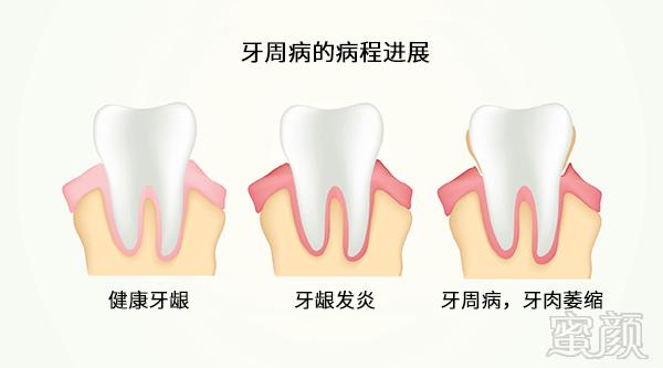 案例图片