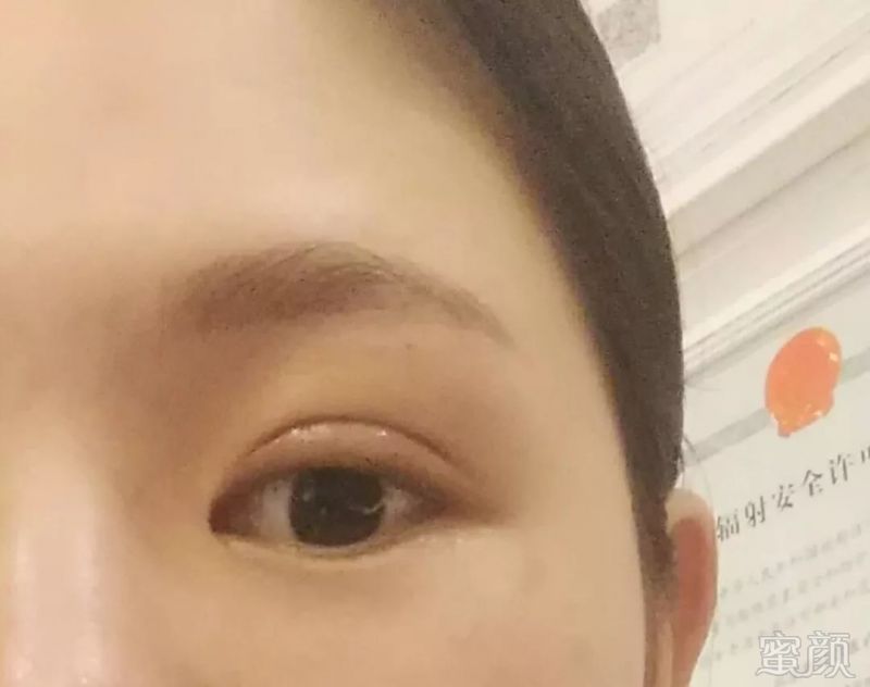 https://img.miyanlife.com/mnt/timg/180701/10494S350-7.jpg
