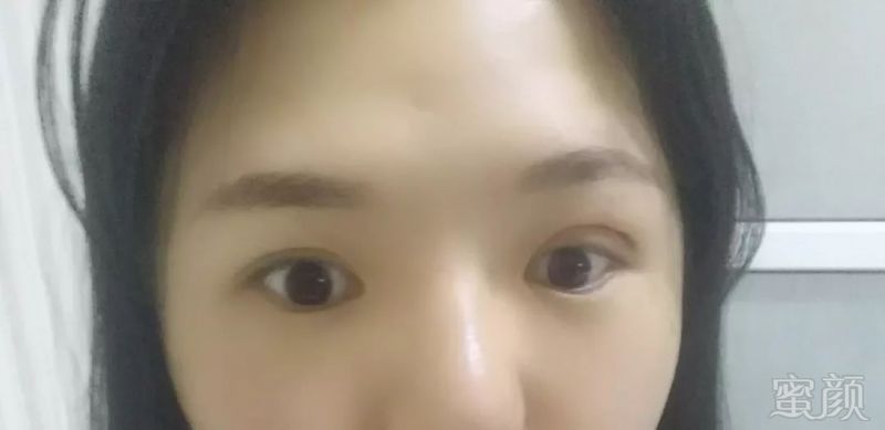 https://img.miyanlife.com/mnt/timg/180701/10494UW4-6.jpg