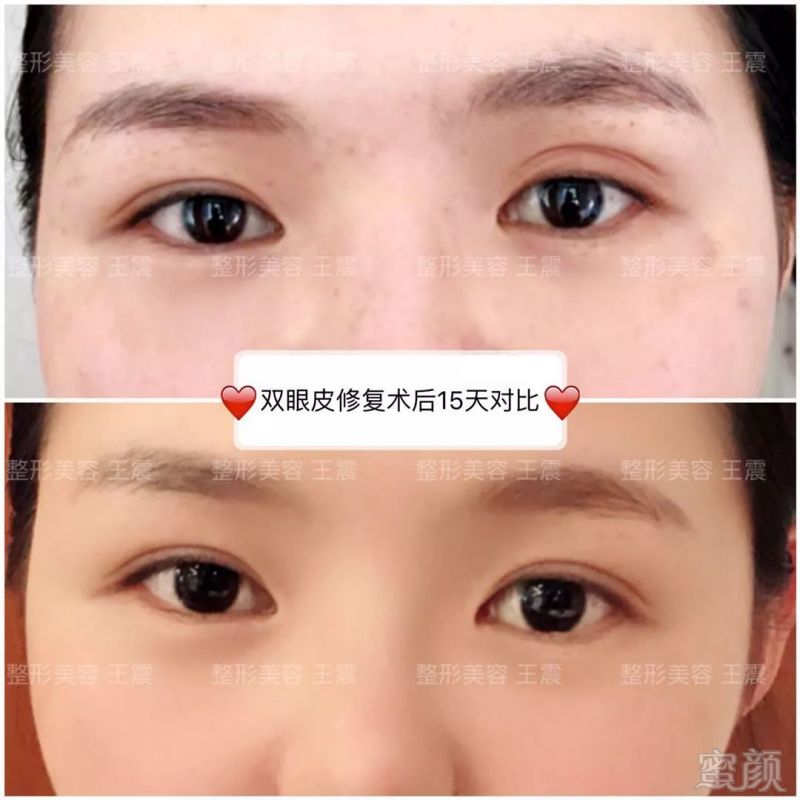 https://img.miyanlife.com/mnt/timg/180701/1049511a0-11.jpg