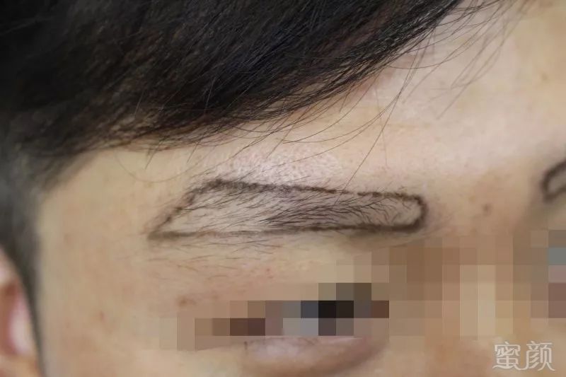 https://img.miyanlife.com/mnt/timg/180701/104GVF2-1.jpg