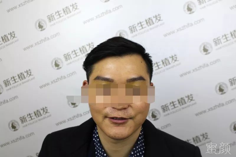 https://img.miyanlife.com/mnt/timg/180701/104H04400-4.jpg