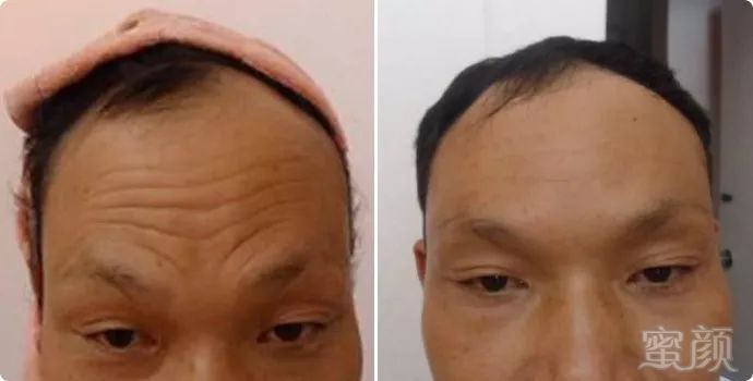 https://img.miyanlife.com/mnt/timg/180701/105100P00-2.jpg
