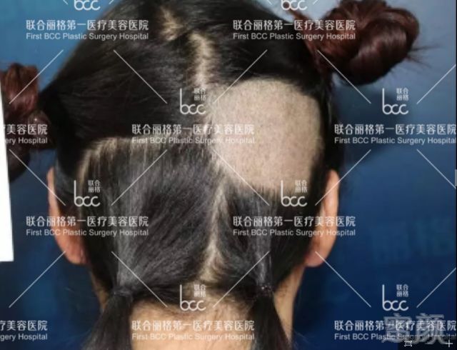 https://img.miyanlife.com/mnt/timg/180701/1102314535-1.jpg