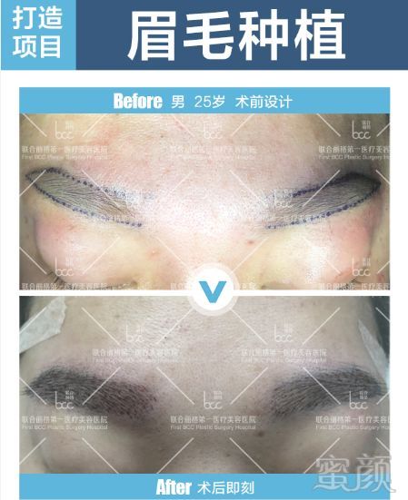 https://img.miyanlife.com/mnt/timg/180701/11023220A-5.jpg