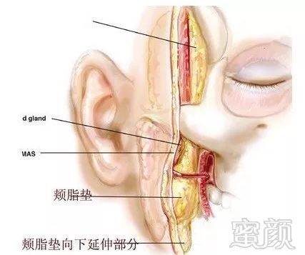 案例图片