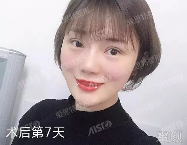 https://img.miyanlife.com/mnt/timg/180701/11100TE3-2.jpg