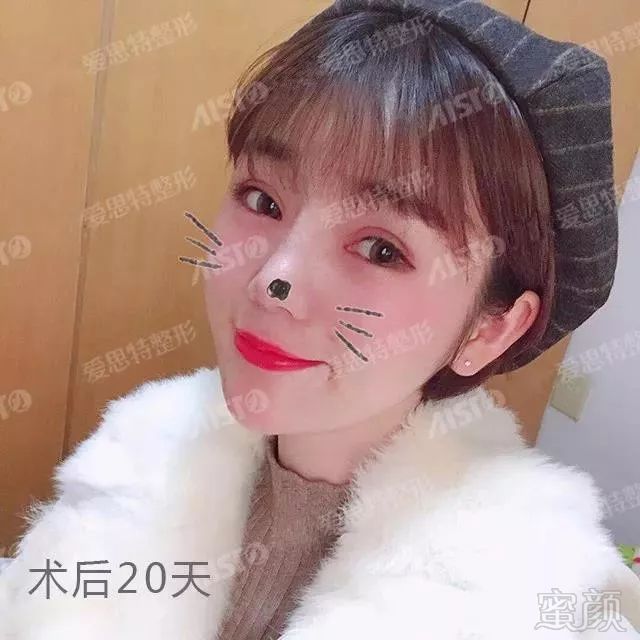 https://img.miyanlife.com/mnt/timg/180701/1110132S7-5.jpg