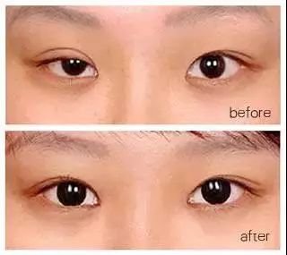 https://img.miyanlife.com/mnt/timg/180701/1110245F3-13.jpg