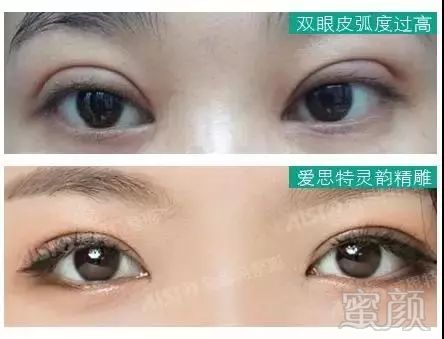 https://img.miyanlife.com/mnt/timg/180701/111024E20-12.jpg