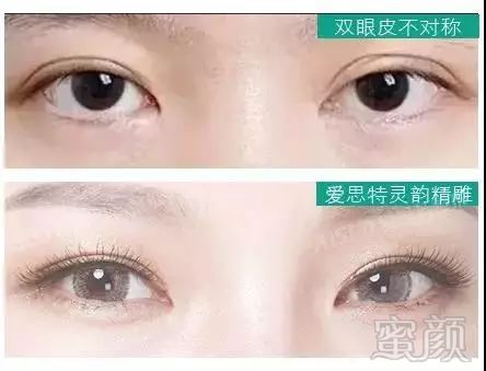 https://img.miyanlife.com/mnt/timg/180701/111024F24-14.jpg