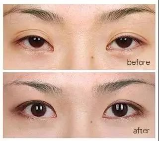 https://img.miyanlife.com/mnt/timg/180701/111025J16-15.jpg