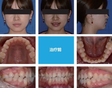 https://img.miyanlife.com/mnt/timg/180701/1244101115-3.jpg