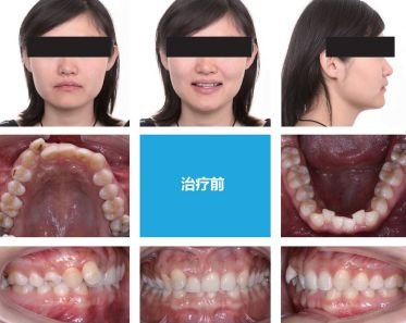https://img.miyanlife.com/mnt/timg/180701/12441043b-4.jpg