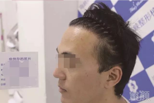 https://img.miyanlife.com/mnt/timg/180701/1245462T8-4.jpg