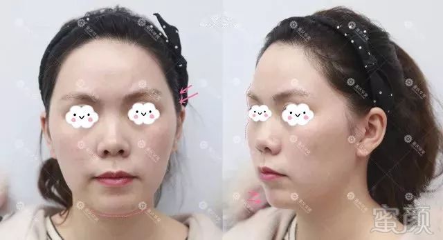https://img.miyanlife.com/mnt/timg/180701/125234CE-0.jpg