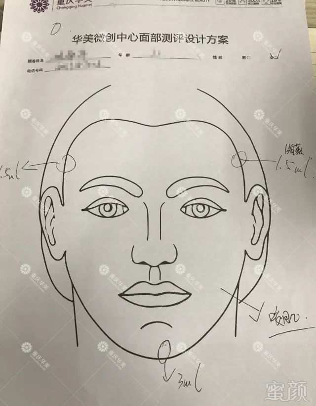https://img.miyanlife.com/mnt/timg/180701/125235EJ-2.jpg