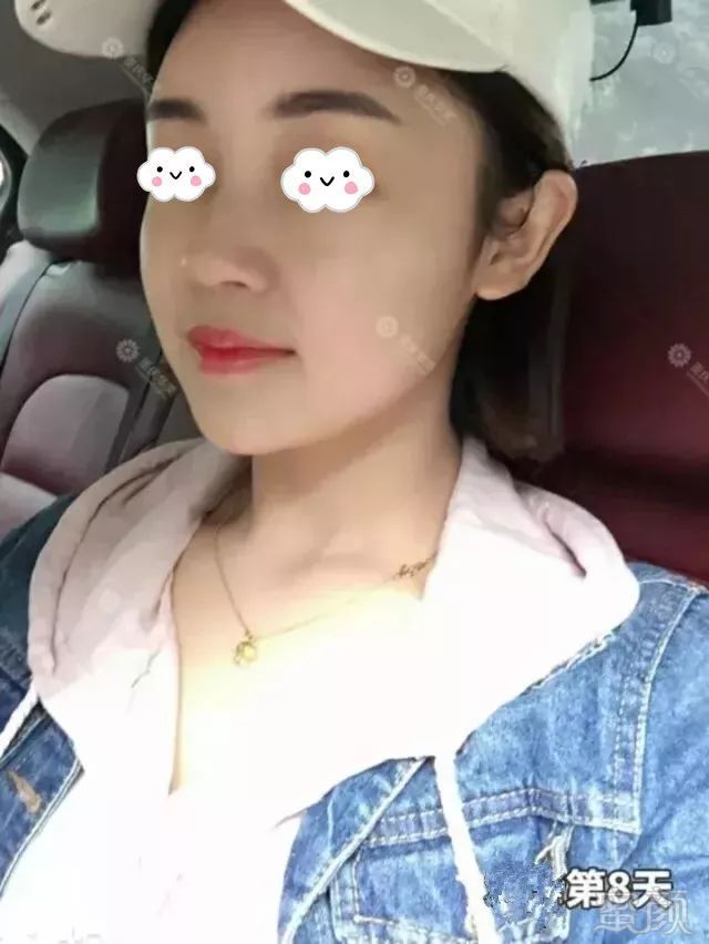 https://img.miyanlife.com/mnt/timg/180701/12523J2S-12.jpg