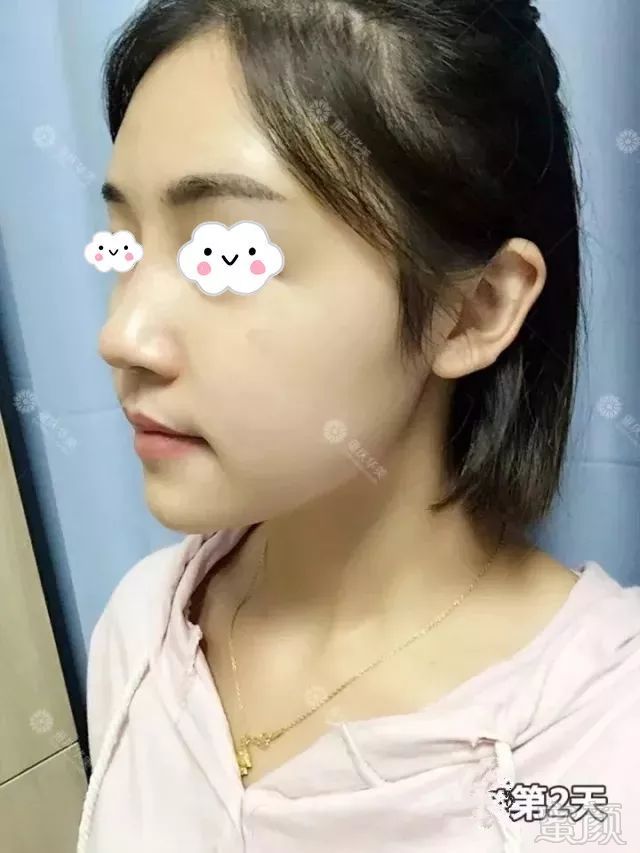 https://img.miyanlife.com/mnt/timg/180701/12523LU0-10.jpg