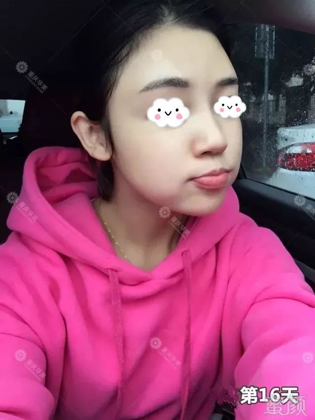 https://img.miyanlife.com/mnt/timg/180701/12523WY6-13.jpg