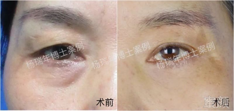 https://img.miyanlife.com/mnt/timg/180701/134G33328-4.jpg