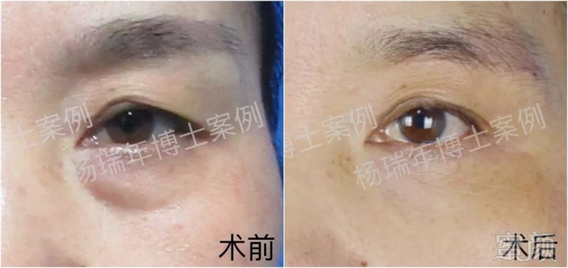 https://img.miyanlife.com/mnt/timg/180701/134G340U-2.jpg