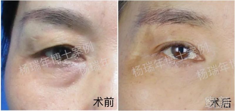 https://img.miyanlife.com/mnt/timg/180701/134G349A-3.jpg