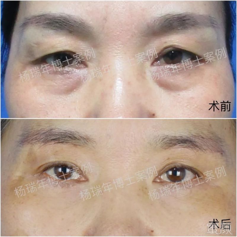 https://img.miyanlife.com/mnt/timg/180701/134G43P1-5.jpg