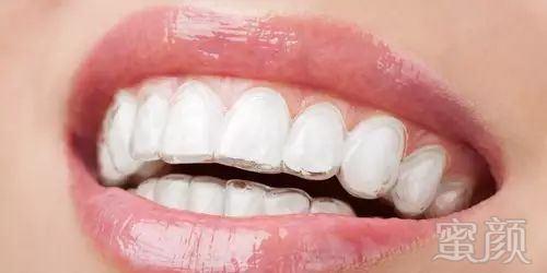 https://img.miyanlife.com/mnt/timg/180702/1100244209-6.jpg