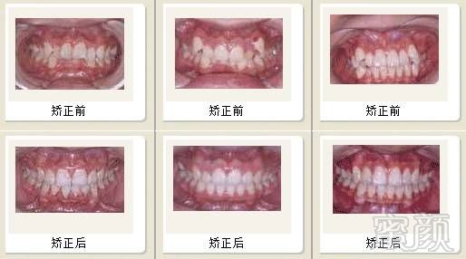 https://img.miyanlife.com/mnt/timg/180702/110050M94-12.jpg