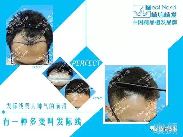 https://img.miyanlife.com/mnt/timg/180702/1105251F5-0.jpg