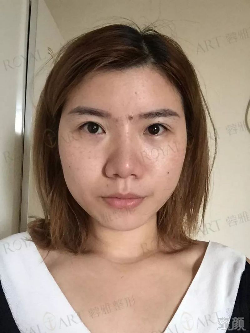 https://img.miyanlife.com/mnt/timg/180702/111452N64-1.jpg
