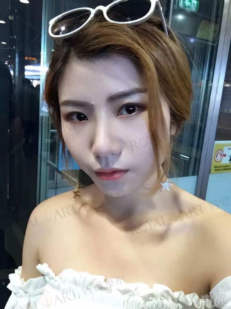 https://img.miyanlife.com/mnt/timg/180702/1114552T8-6.jpg