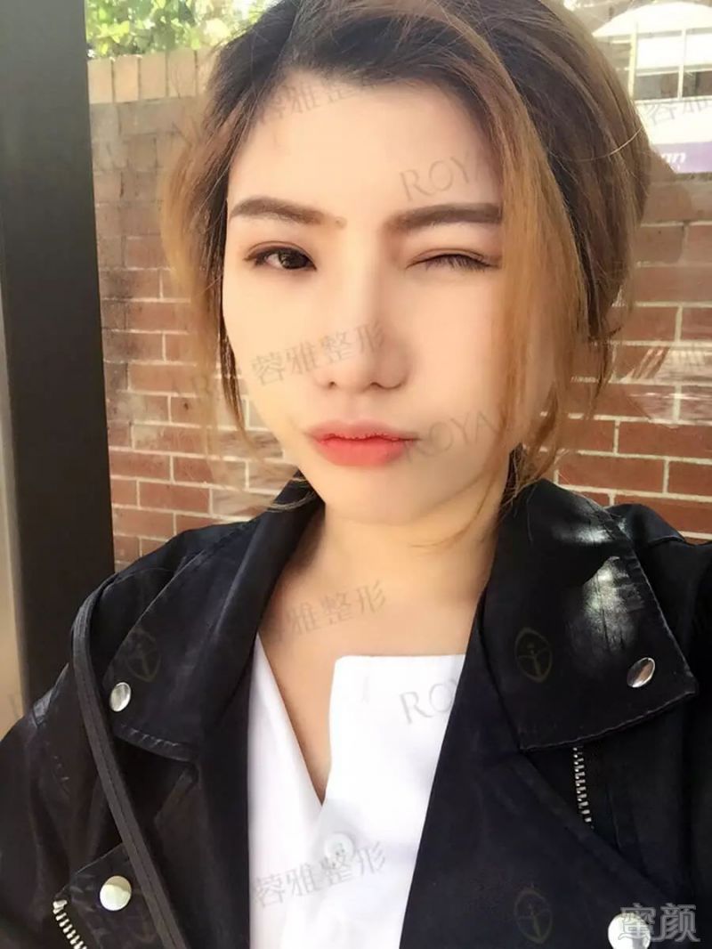 https://img.miyanlife.com/mnt/timg/180702/11145BX3-7.jpg