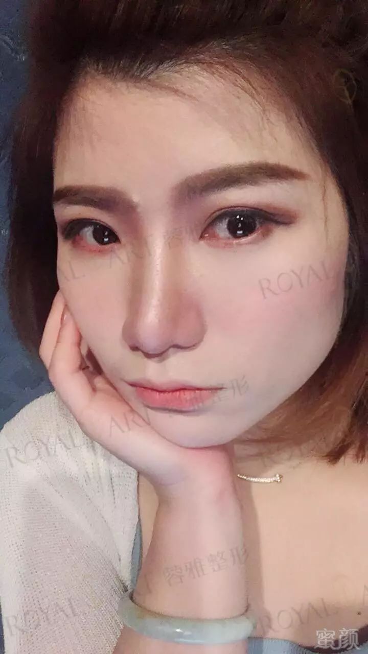 https://img.miyanlife.com/mnt/timg/180702/11145U142-11.jpg
