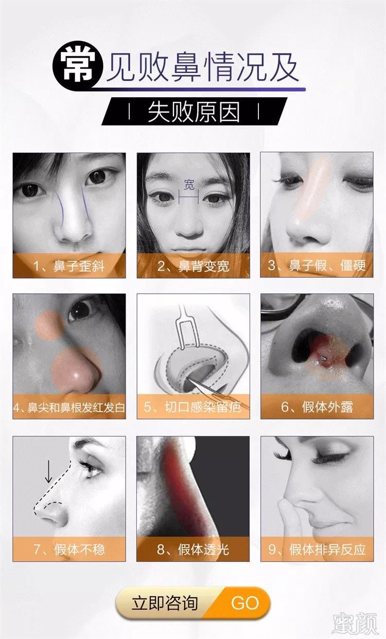 https://img.miyanlife.com/mnt/timg/180702/11145a123-13.jpg