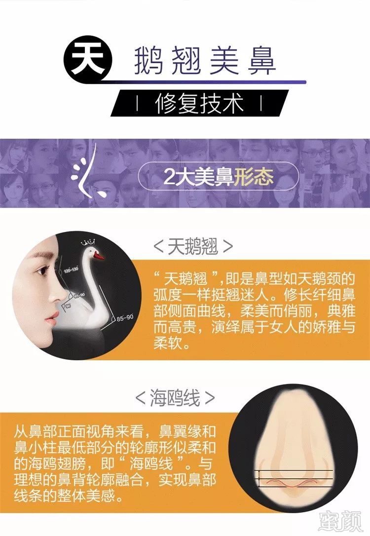 https://img.miyanlife.com/mnt/timg/180702/11145aG6-14.jpg
