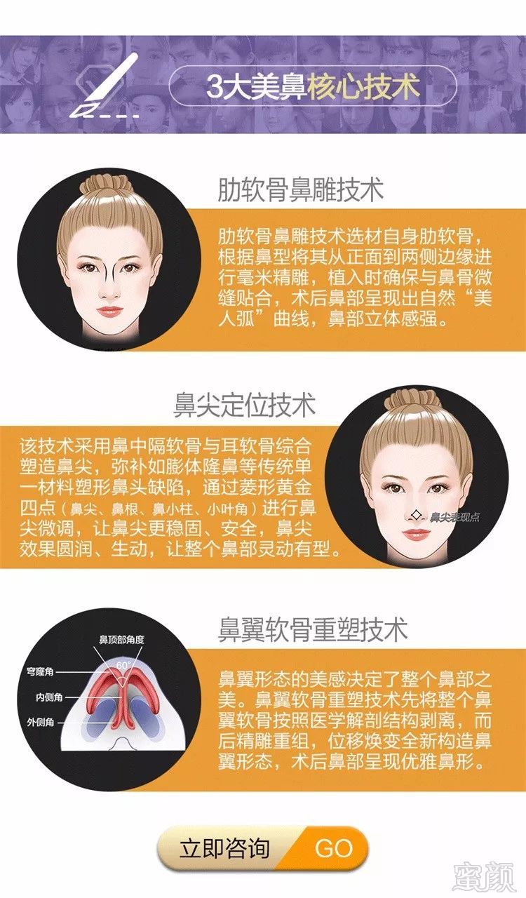https://img.miyanlife.com/mnt/timg/180702/1115002144-15.jpg