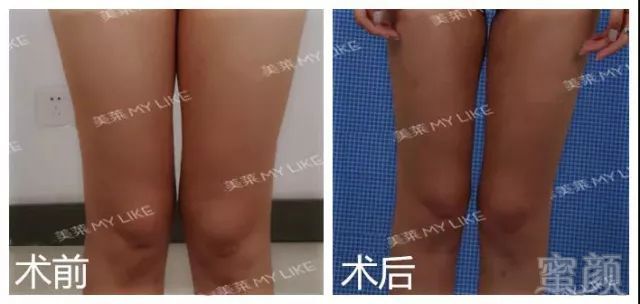 https://img.miyanlife.com/mnt/timg/180702/1341045091-2.jpg