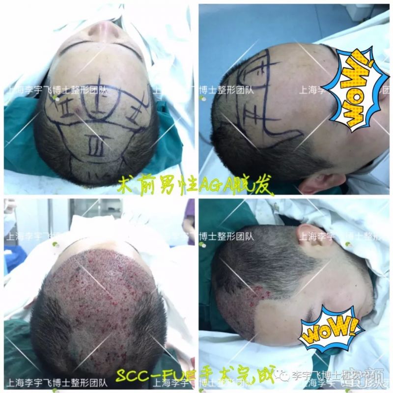https://img.miyanlife.com/mnt/timg/180702/13412aW2-6.jpg