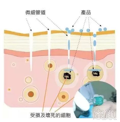 案例图片